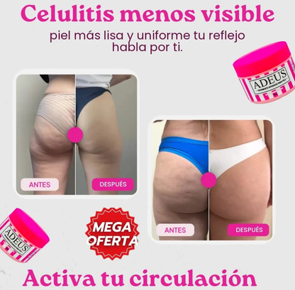 ADEUS Crema – Repara, Hidrata y Elimina Estrías en Pocos Días 💫