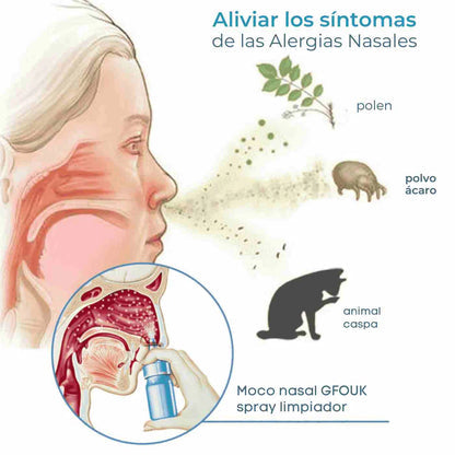 🌸 ¡Dile adiós a la congestión! Gfouk Spray Nasal 2x1 💧